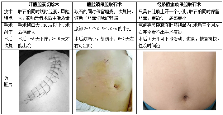 多大的胆结石需要治疗？一定要切胆吗？(图3)