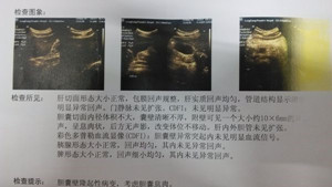 治疗胆结石都有哪些花费？(图1)