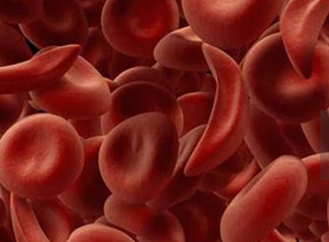 胆结石的形成因素有哪些？(图2)