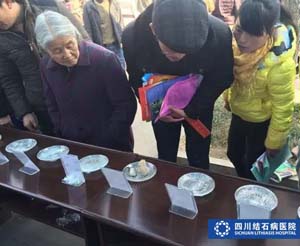 【中国新闻网】四川结石病医院结石展引爆大竹 好评如潮！(图2)