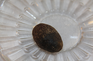 清楚认识胆结石，对症治疗是关键！(图1)