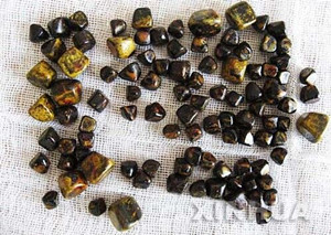 多发性胆结石剖析(图1)