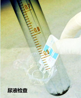 专家为你解答：输尿管结石检查方法有哪些?(图1)