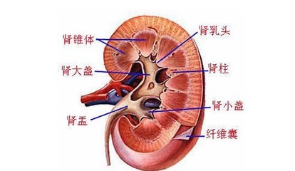 肾结石积水怎么办(图1)