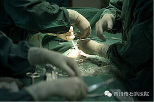 胆结石的手术方法是什么？(图3)
