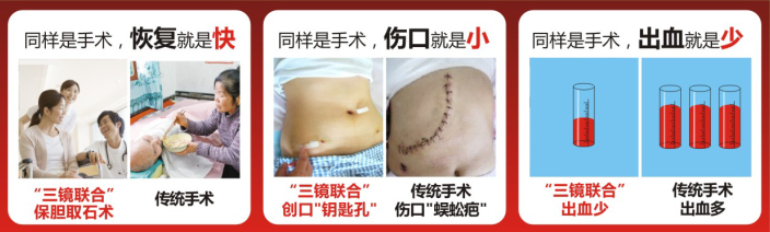 治疗误区：胆结石不可以排石！(图3)