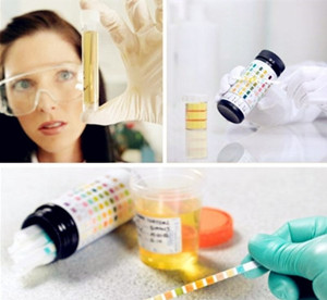 检查肾结石的方法有哪些(图2)