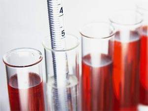 哪些是肾结石的常见病症(图1)