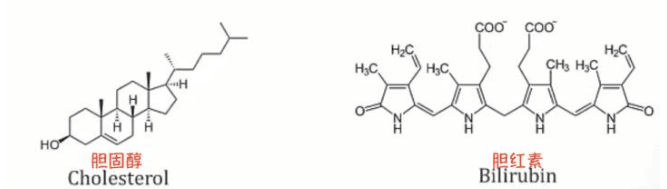 有了结石就该选个正经方法治疗，不要“道听途说”(图1)