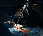 胆结石的极佳疗法——经脐隐瘢痕保胆取石术(图4)